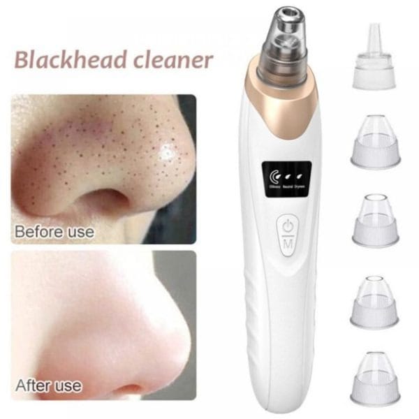 Electric Blackhead Remover - Image 3