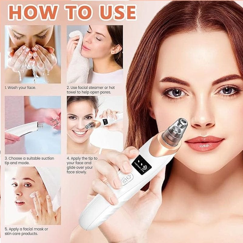 Electric Blackhead Remover - Image 5